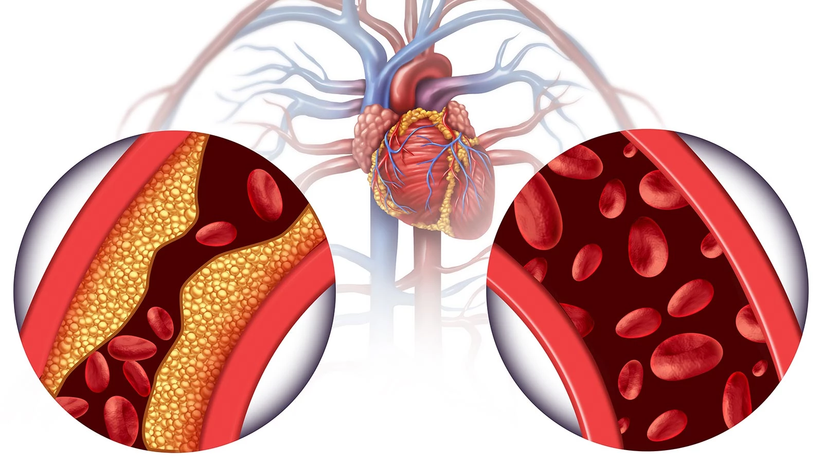 TERAPIAS DE QUELACION